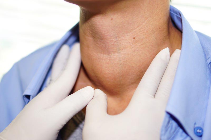 Bác sĩ thăm khám lâm sàng để xác định sự hiện diện của khối u tuyến giáp 
