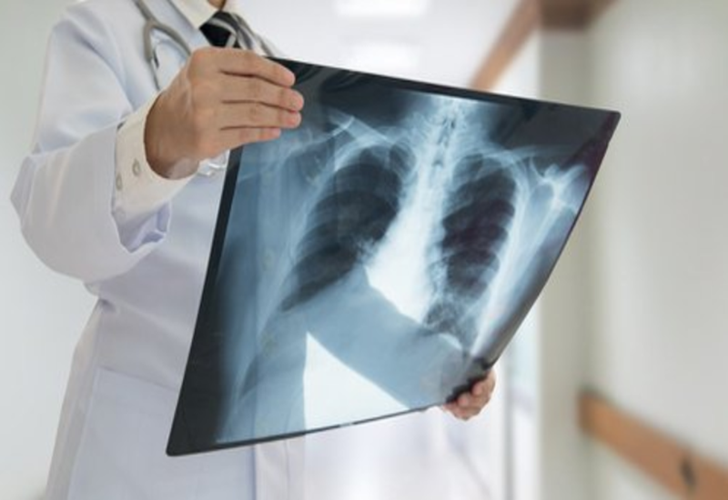 Kén khí phổi gây triệu chứng rõ ràng hay không?