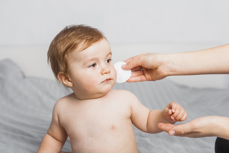 Bệnh chàm sữa thường gặp ở trẻ nhỏ