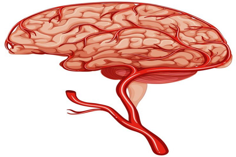 Đột quỵ não có thể dẫn đến động kinh thùy trán