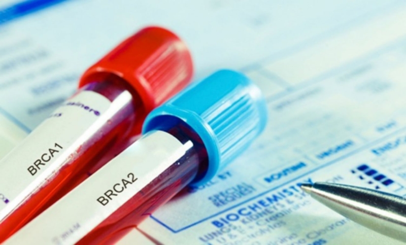 Xét nghiệm gen BRCA giúp phát hiện đột biến gen BRCA1 và BRCA2 