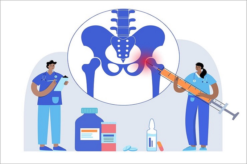 Khả năng chữa khỏi viêm khớp cùng chậu phụ thuộc nhiều vào mức độ bệnh và thời điểm điều trị