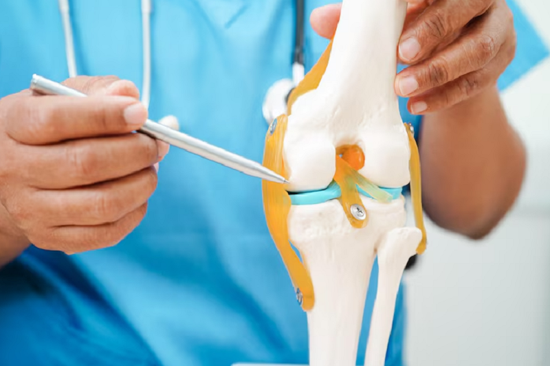 Khớp gối nhân tạo giúp phục hồi khả năng vận động khớp gối 