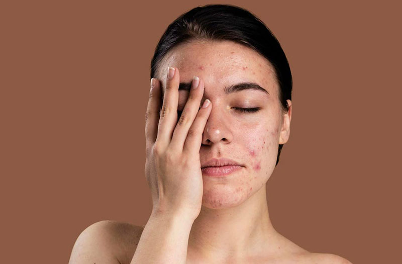 Người có làn da nhạy cảm tuyệt đối không nên rửa mặt bằng nước đá 