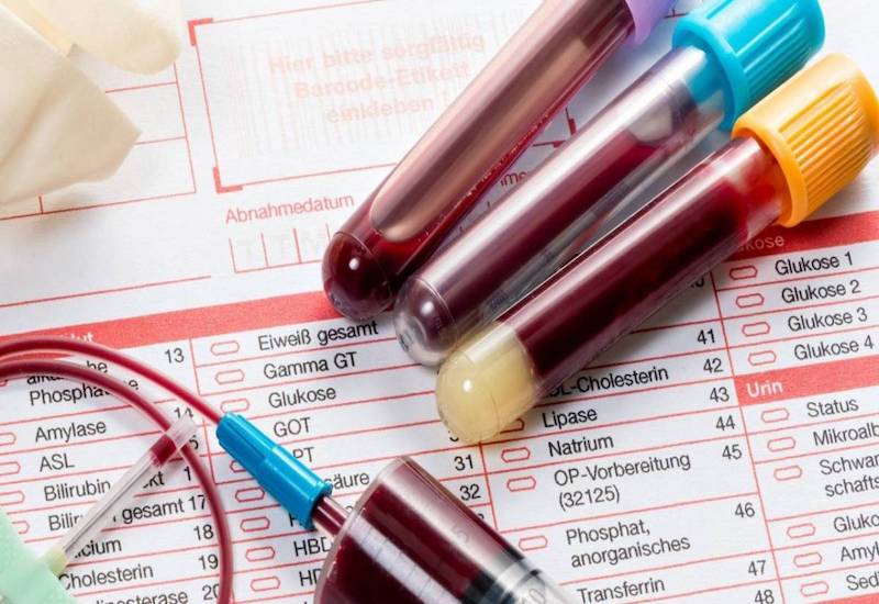 Xét nghiệm máu giúp phát hiện bệnh lý và tìm kiếm các chất lạ trong máu