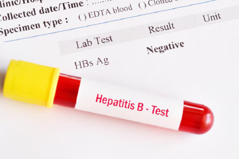Người bị viêm gan B mạn tính cần đo tải lượng DNA virus định kỳ theo chỉ định của bác sĩ 