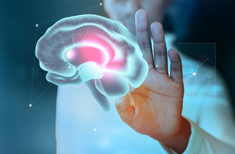 Dị dạng mạch máu não là một dạng dị tật bẩm sinh 