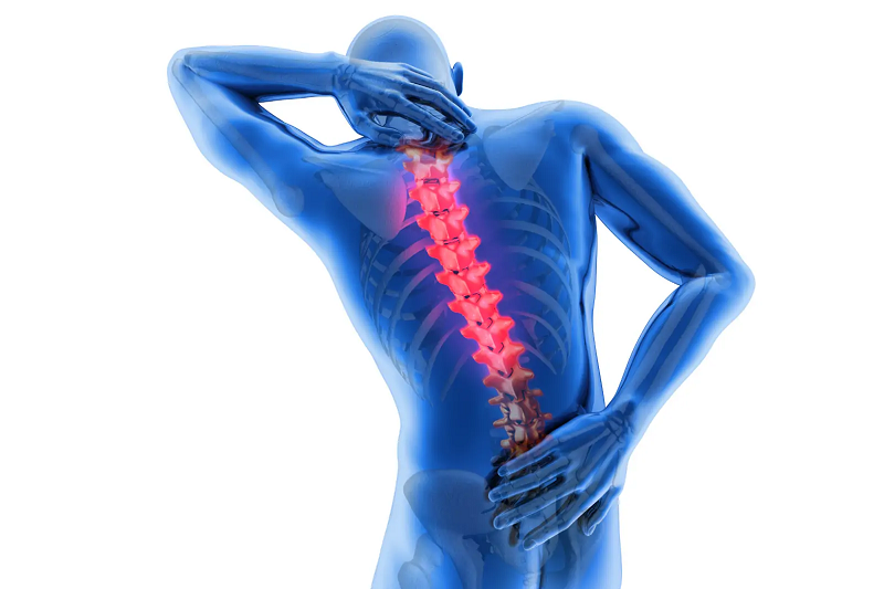 Thoái hoá đốt sống ngực thường tiến triển âm thầm và dễ bị bỏ sót.