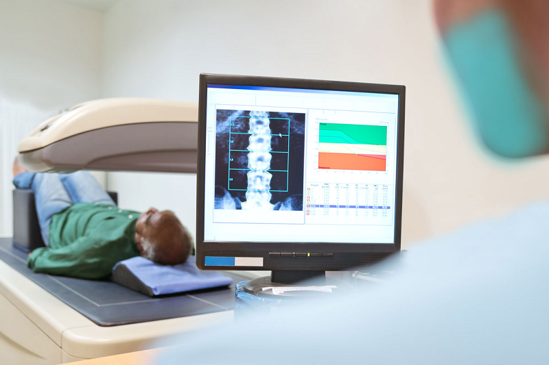  Đo mật độ xương (DEXA scan) giúp đánh giá loãng xương khi nghi ngờ.