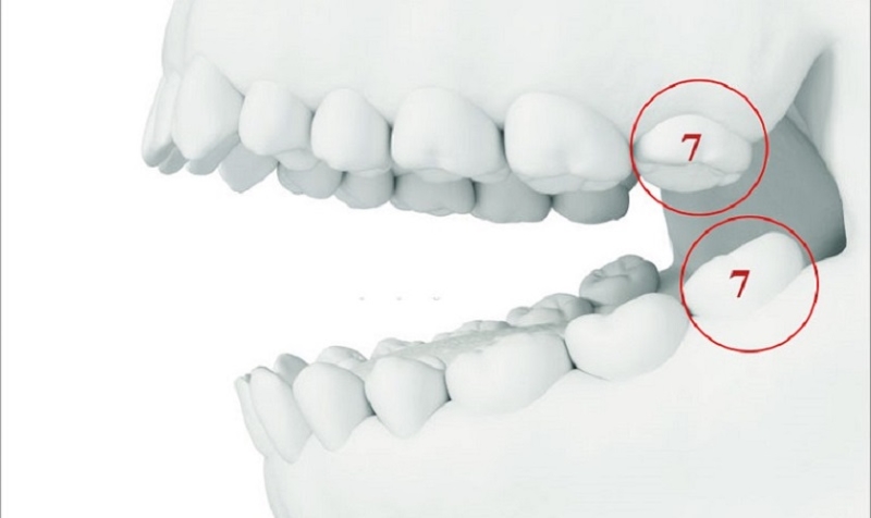 Răng số 7 đảm nhận chức năng nhai chính 