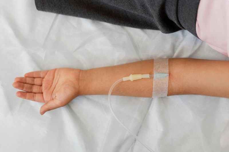 Truyền dịch bù nước và điện giải giúp điều trị triệu chứng trong viêm màng não vô khuẩn