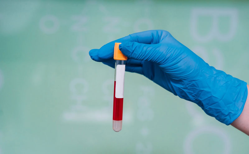 Xét nghiệm HbA1c giúp kiểm tra đường huyết, hỗ trợ chẩn đoán tiểu đường