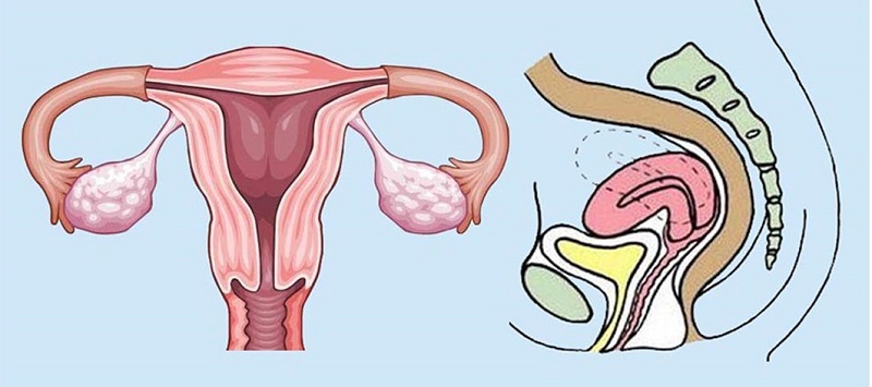 Cách tử cung ngả trước hay sau thì tốt để giữ sức khỏe tốt