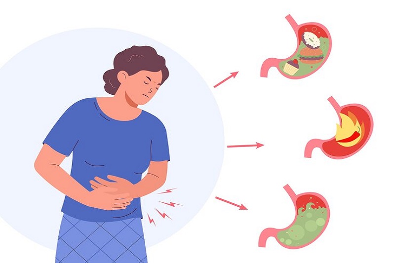 Thừa axit dạ dày gây nên nhiều triệu chứng khó chịu cho người bệnh