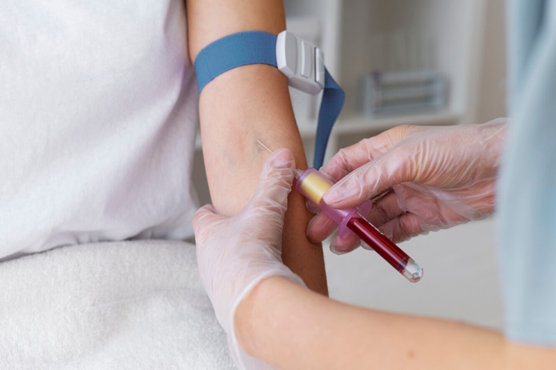 ASLO (Anti-Streptolysin O) là xét nghiệm chính trong chẩn đoán viêm khớp liên cầu