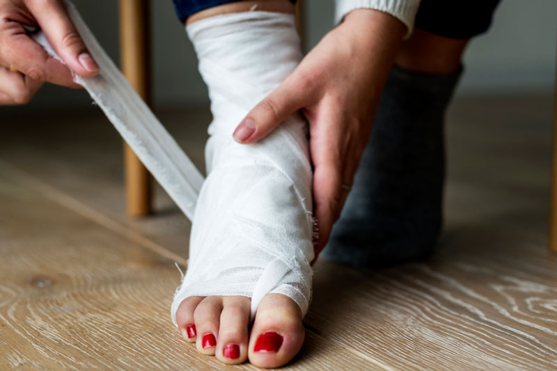 Gãy ngón chân út có cần bó bột không còn phụ thuộc vào mức độ nghiêm trọng