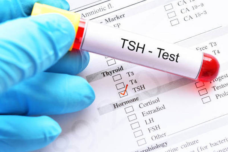 Xét nghiệm TSH là một trong những xét nghiệm cơ bản ban đầu nhằm đánh giá chức năng tuyến giáp 