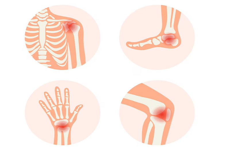 Viêm khớp dạng thấp là bệnh lý tự miễn có thể gây nổi hạch ở bẹn