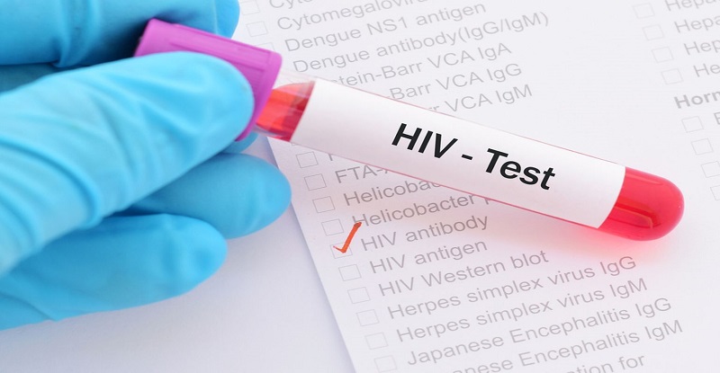 Khám sức khỏe công ty có xét nghiệm HIV không - câu trả lời là chỉ có trong một số trường hợp được yêu cầu 