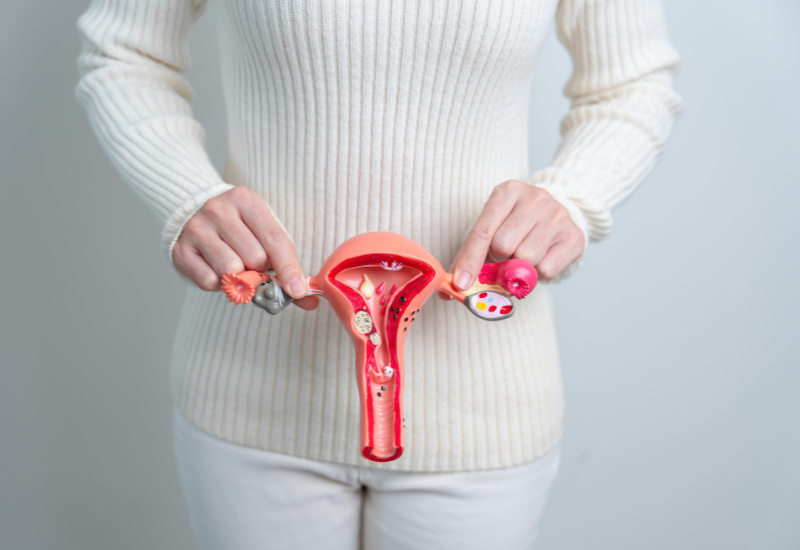 PCOS là một rối loạn nội tiết thường gặp liên quan đến sự gia tăng bất thường hormone androgen