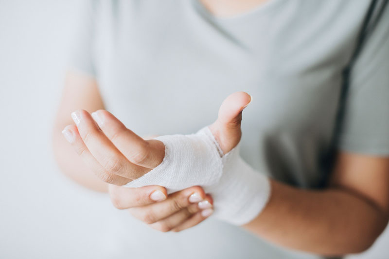Phù nề là biến chứng có thể xuất hiện ở người đang bó bột 