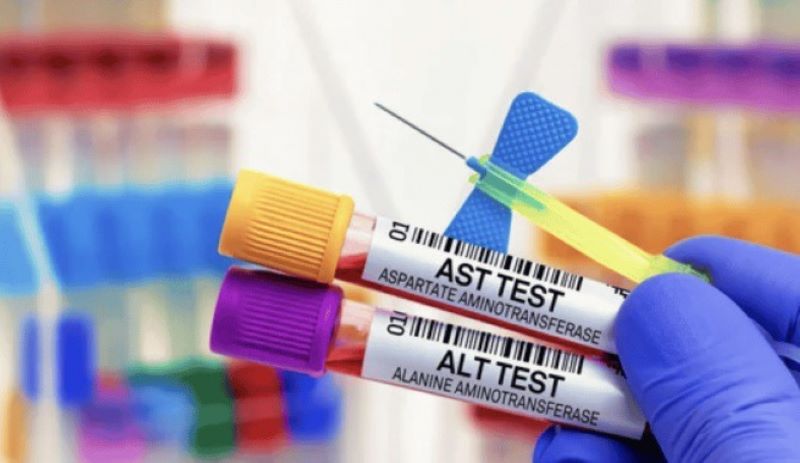 AST và ALT là hai chỉ số xét nghiệm đầu tay trong tầm soát bệnh viêm gan 
