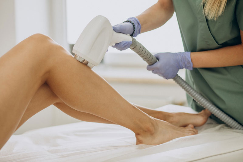 Triệt lông là phương pháp làm đẹp được yêu thích hiện nay
