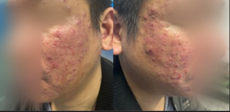 Da bệnh nhân xuất hiện nhiều vùng mẩn đỏ kèm tình trạng ngứa  
