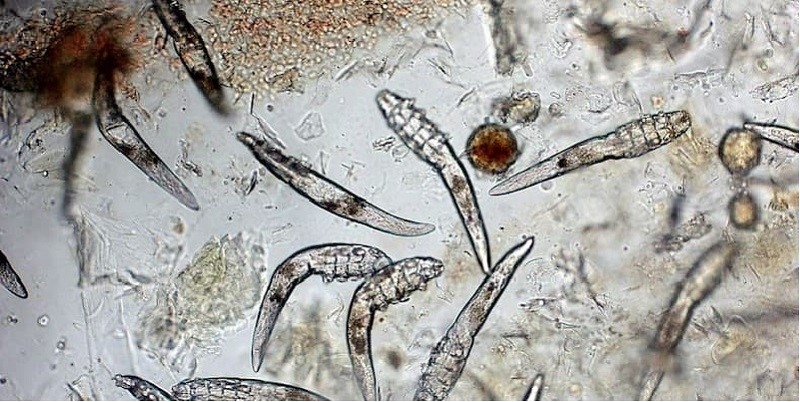 Demodex có khả năng ký sinh trên da và gây ra nhiều bệnh lý da liễu  