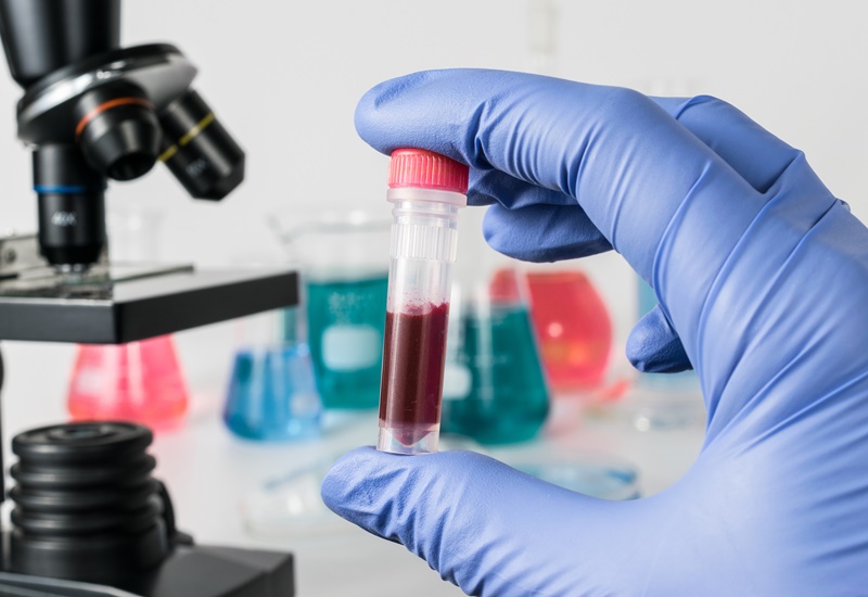 Xét nghiệm viêm gan B HBsAg giúp kiểm tra người thực hiện có đang nhiễm virus viêm gan B hay không