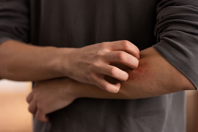 Quá trình sử dụng thuốc, người dùng đôi khi thường gặp phải tình trạng phát ban, ngứa ngáy