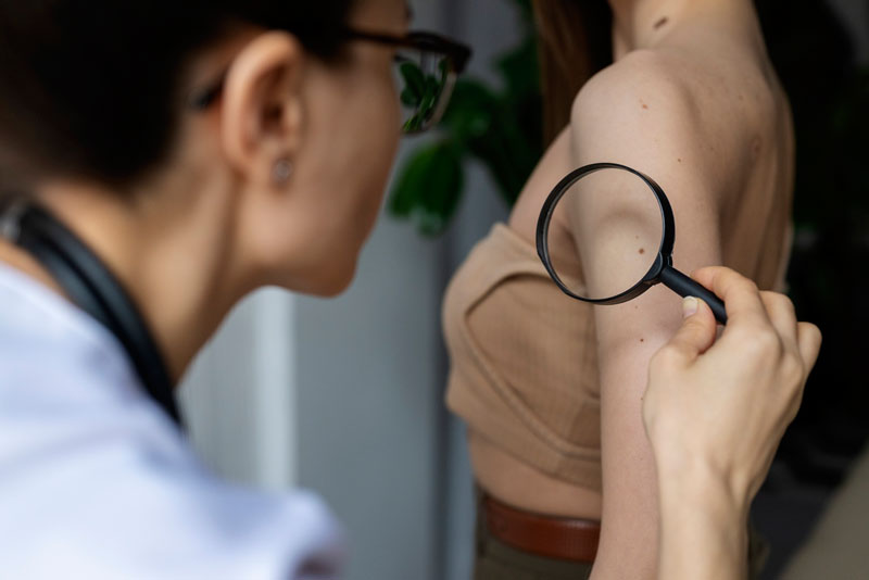 Bác sĩ tiến hành soi da, kiểm tra dấu hiệu bất thường trên da