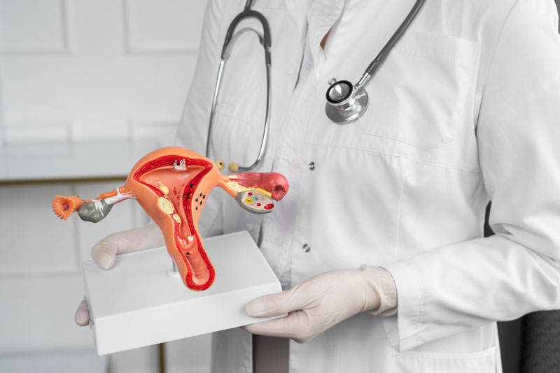 U xơ tử cung ở nữ giới thường gây tình trạng đau vùng chậu, chảy máu âm đạo
