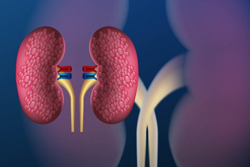 <a href='https://medlatec.vn/tu-dien-benh-ly/suy-than-man-sLrgn' title='Suy thận mạn'>Suy thận mạn</a> khiến chức năng thận bị giảm sút nghiêm trọng