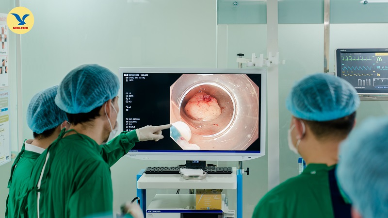 Người bệnh được chẩn đoán bệnh thông qua nội soi đại trực tràng