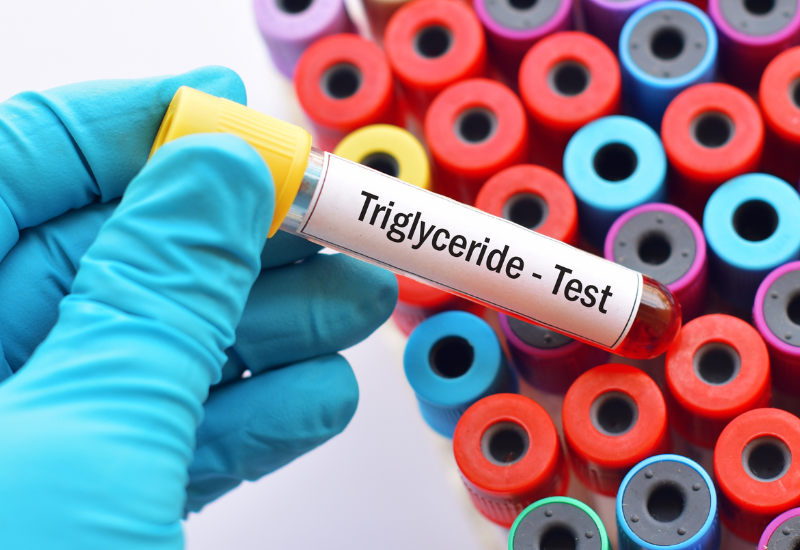 MEDLATEC hỗ trợ bạn theo dõi, đánh giá toàn diện chỉ số Triglyceride và điều trị Triglyceride cao hiệu quả