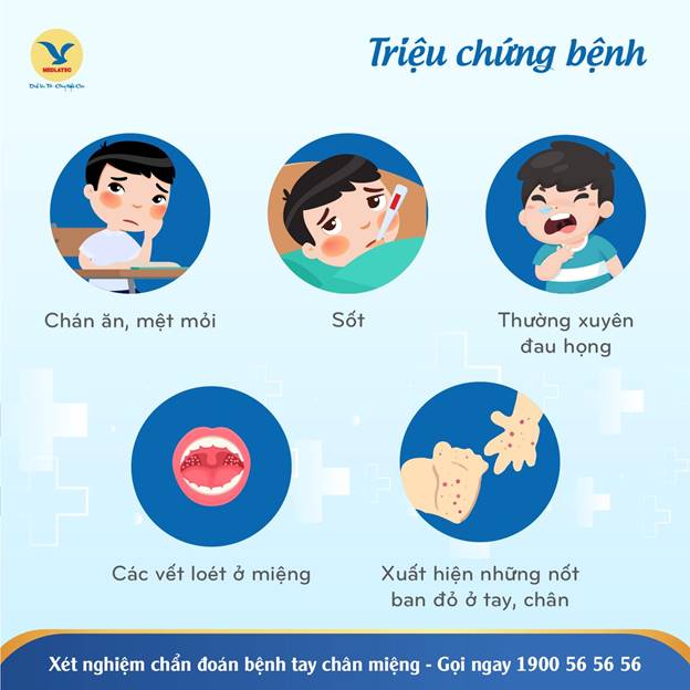 Biểu hiện điển hình của bệnh tay chân miệng