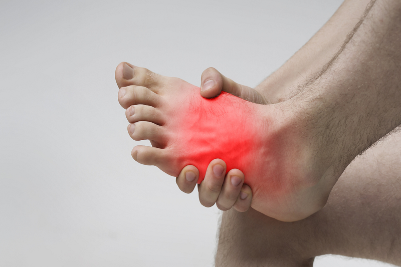 Viêm khớp bàn chân thường bị bỏ sót trong các bệnh lý về khớp.