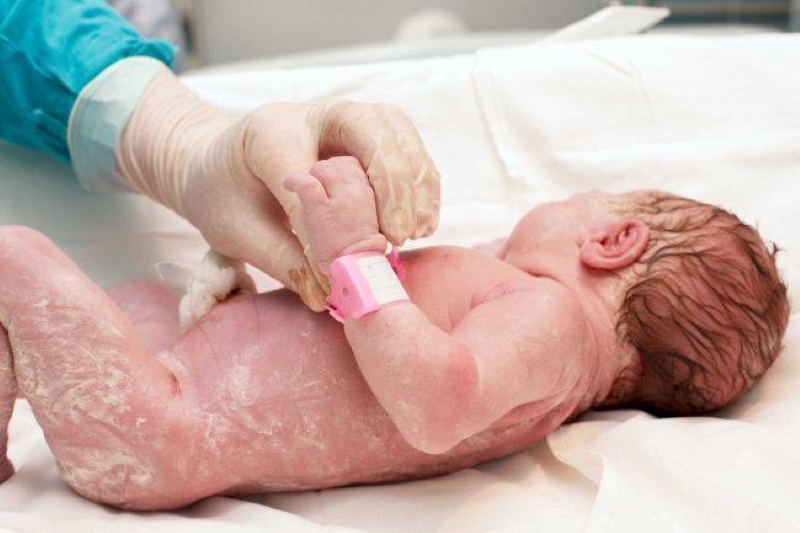 Apgar là chỉ số có vai trò quan trọng đối với sức khỏe của trẻ sơ sinh 