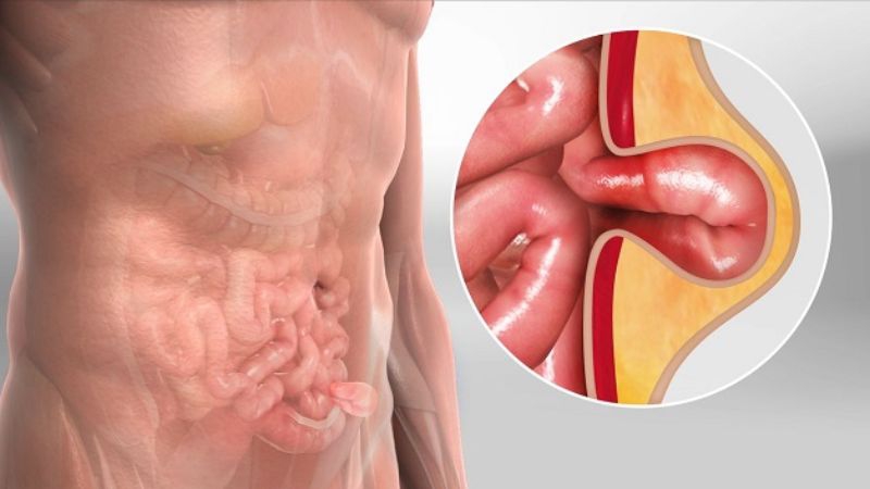 Động mạch thượng vị dưới có vai trò quan trọng trong việc cung cấp máu cho thành bụng dưới 