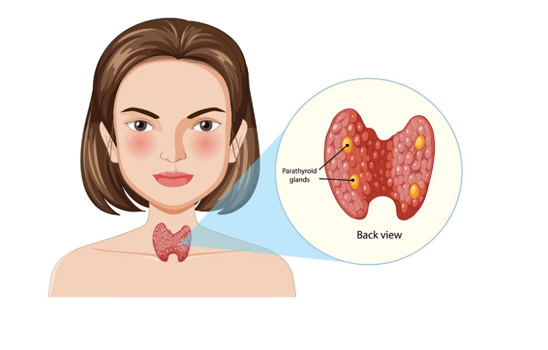 Hình ảnh mô phỏng sự xuất hiện của nhân giáp bên trong tuyến giáp