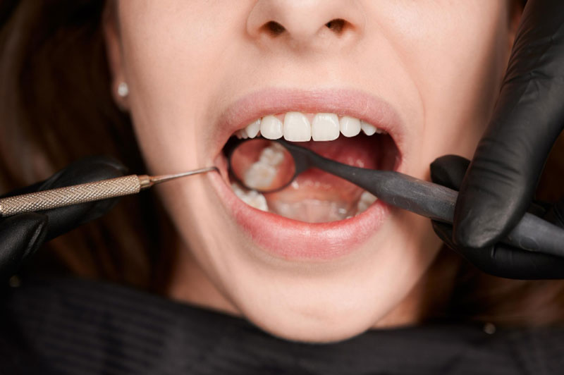 Cả nam giới và nữ giới đều có nguy cơ bị ung thư nướu răng