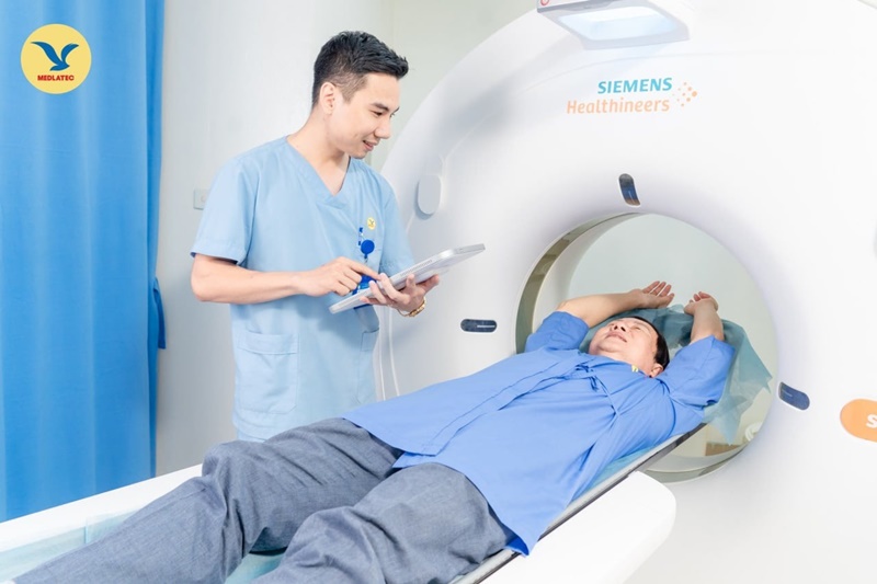 Chụp CT là phương pháp chẩn đoán hình ảnh phổ biến
