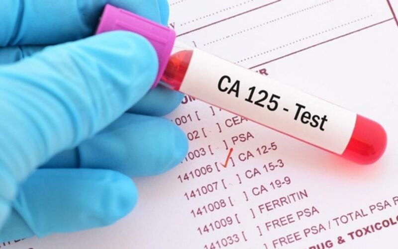 CA125 chủ yếu dùng trong theo dõi và đánh giá điều trị UTBT 
