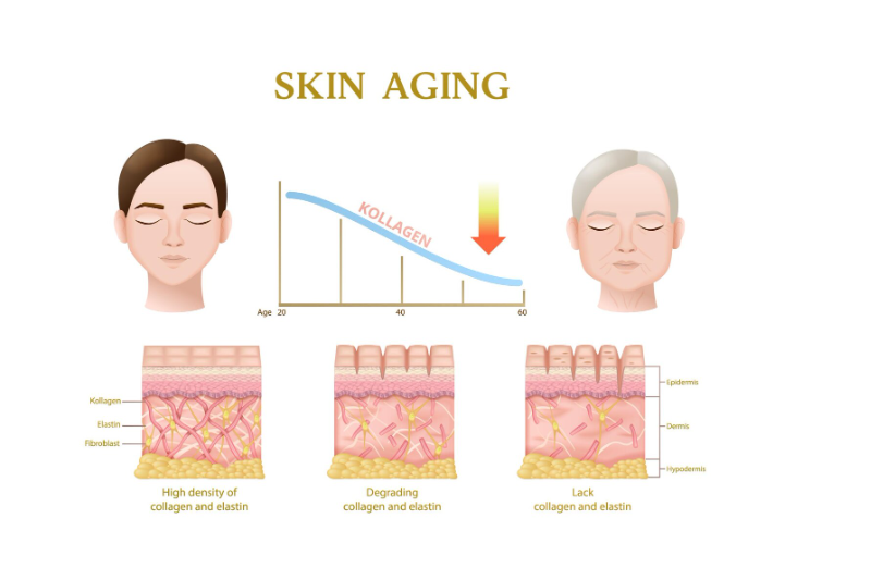 Quá trình lão hóa cơ thể theo tuổi tác là nguyên nhân chính khiến da mặt bị chảy xệ