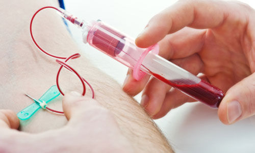 Lấy máu xét nghiệm kháng thể viêm gan B