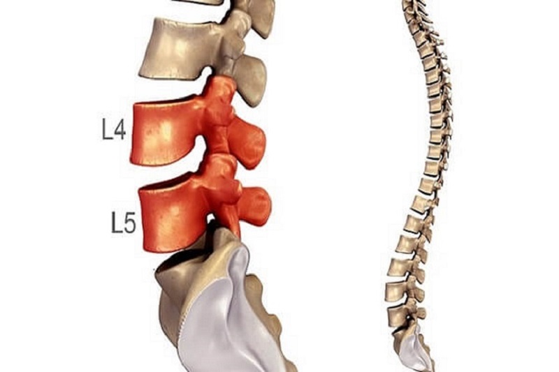 Thoát vị đĩa đệm cột sống có thể xảy ra ở nhiều vị trí 