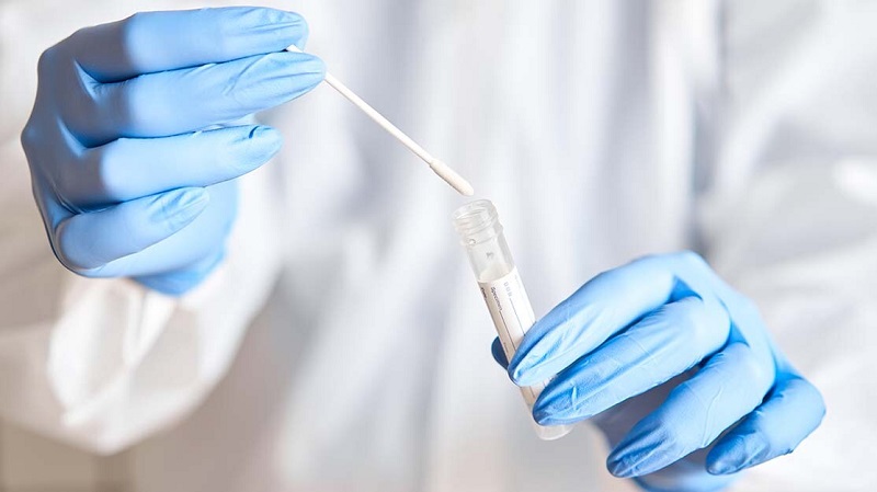 Xét nghiệm là phương pháp chẩn đoán cúm A quan trọng