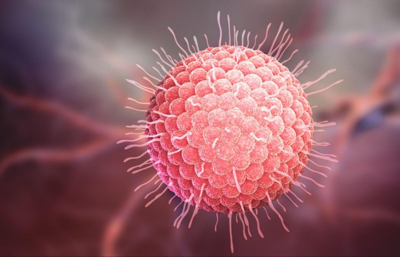 Zona thần kinh là bệnh lý do virus Varicella-Zoster gây ra