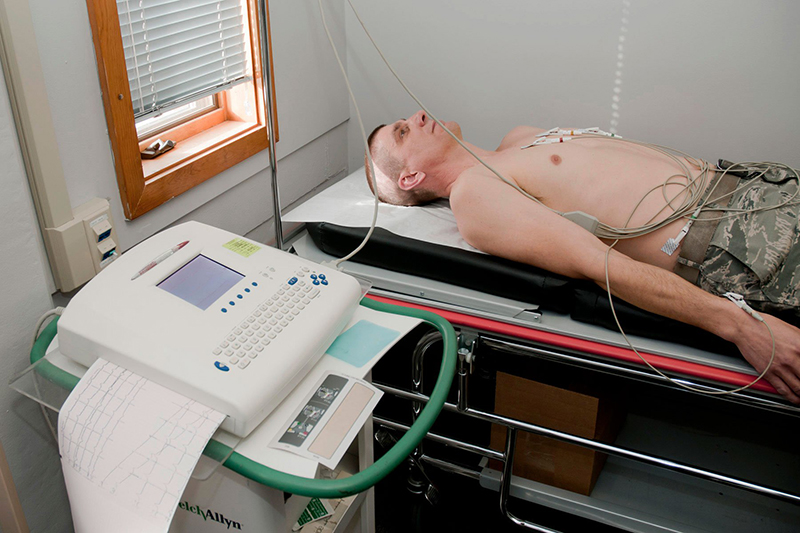 ECG nhồi máu cơ tim giúp bác sĩ phát hiện tình trạng thiếu máu cơ tim cấp tính